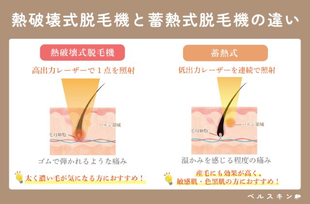 肌質・毛質に合う脱毛機があるか