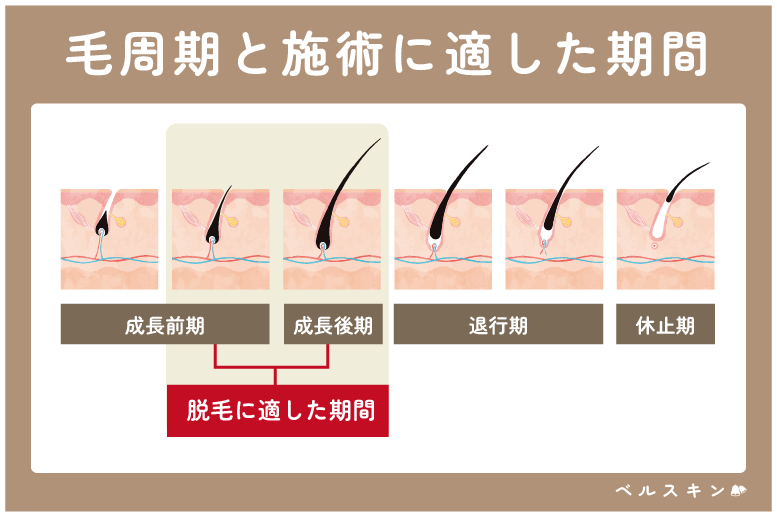 毛周期　脱毛タイミング