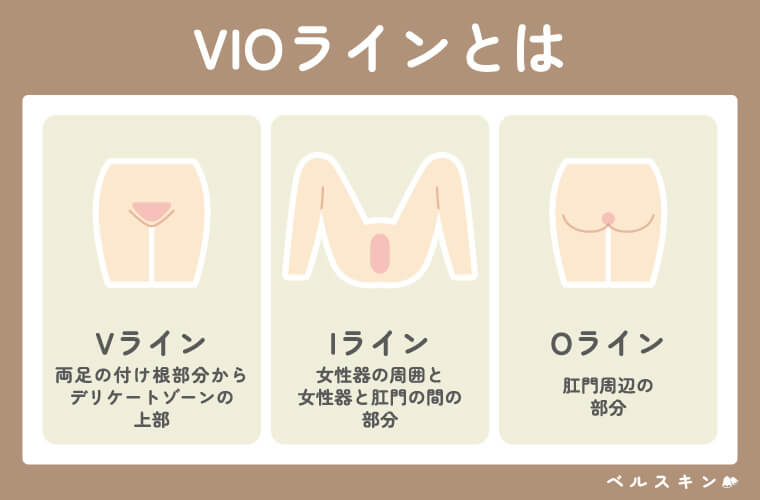 VIO医療脱毛とは【何回でつるつる・薄くなる？】